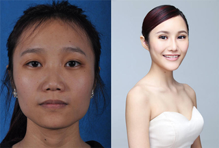 Illustration for article titled Intense Photos of Plastic Surgery Tranformations Going Viral in China